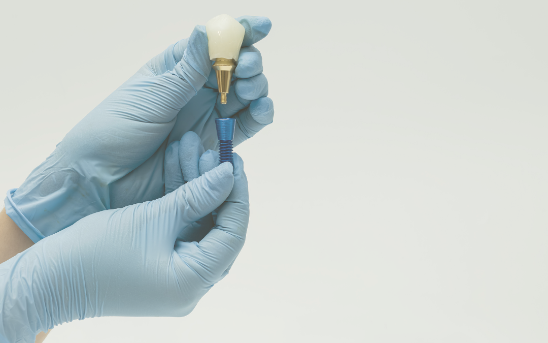 Implante dentário