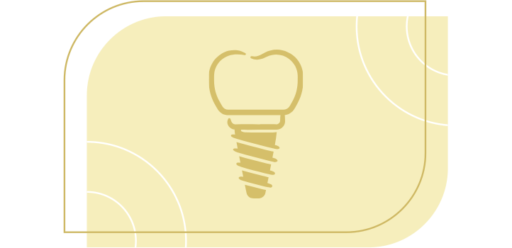 Implantes e Reabilitação